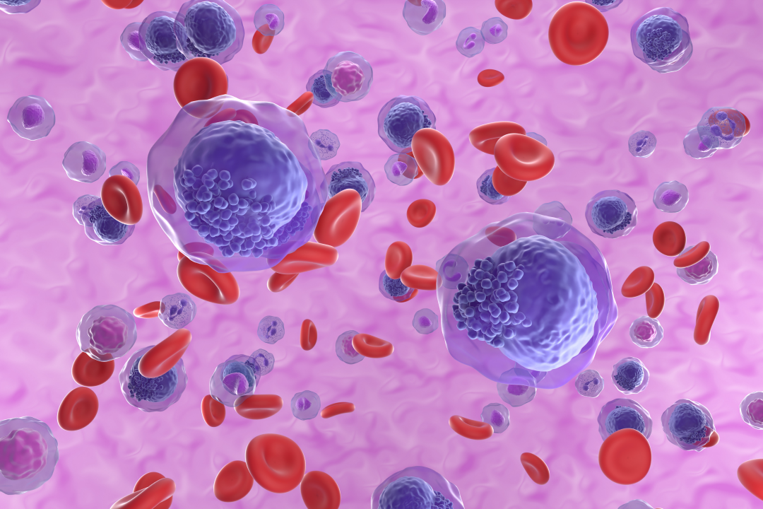 haematologie-teaser-1080x720px